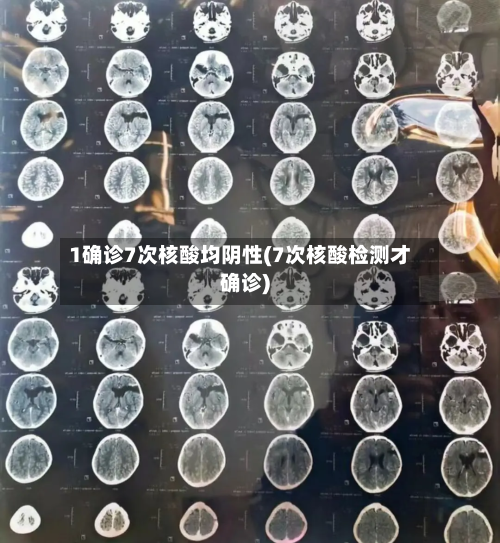 1确诊7次核酸均阴性(7次核酸检测才确诊)