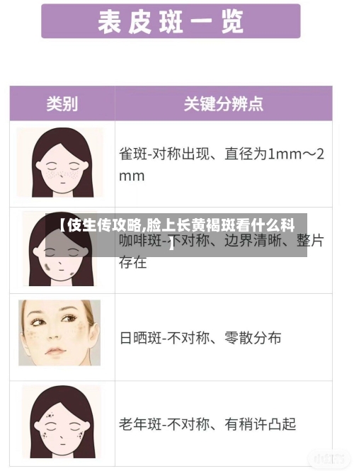 【伎生传攻略,脸上长黄褐斑看什么科】-第1张图片