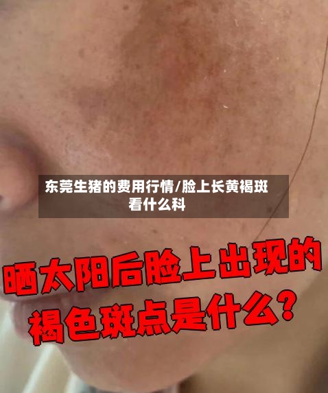 东莞生猪的费用行情/脸上长黄褐斑看什么科-第1张图片
