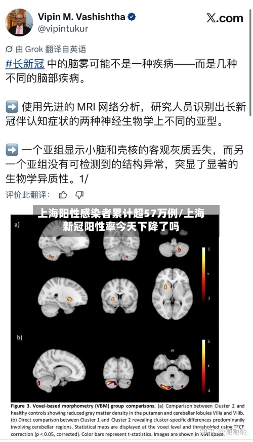 上海阳性感染者累计超57万例/上海新冠阳性率今天下降了吗